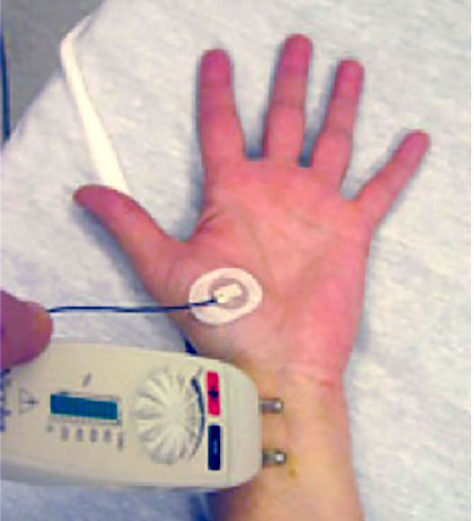 EMG-ve-sinir-keciriciliyi-testi